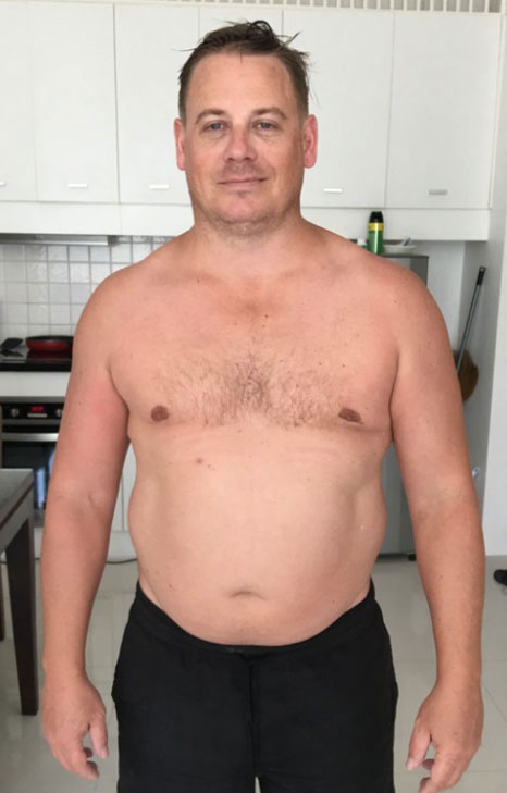 Matthew - Before Photo
